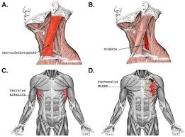 Solved Itracheal Cartilagirs Question 47 The Serratus | Chegg.Com